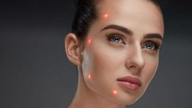 Kas ir frakcionēta ādas atjaunošana